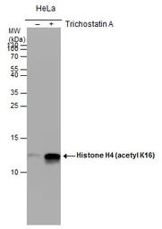 Anti-Histone H4K16ac (Acetyl Lys16) antibody [GT1271] used in Western Blot (WB). GTX632067